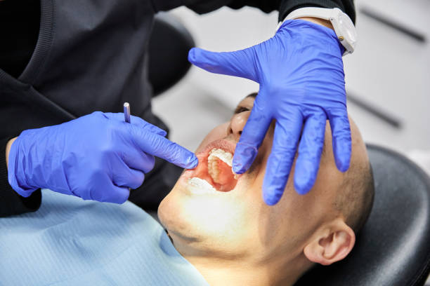 Best Emergency Tooth Extraction in Iva, SC